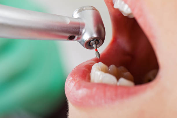 Best Broken or Cracked Tooth Emergency Dentist in Harrison, WI